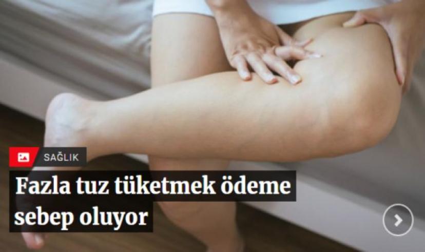 Fazla tuz tüketmek ödeme sebep oluyor
