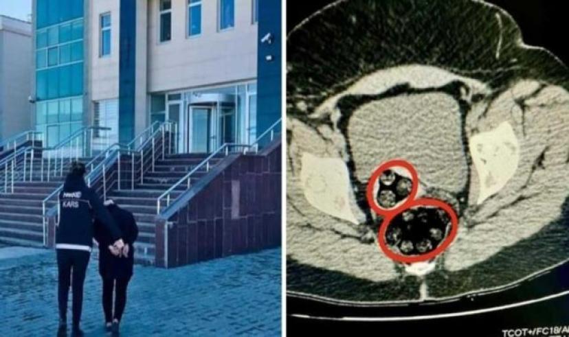 İran uyruklu kadın yolcunun makatında uyuşturucu yakalandı