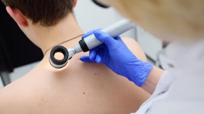 37 ilde ücretsiz deri taraması başladı: Çocuklar öncelikli hedefte