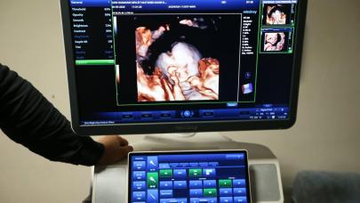 Kars’ta 4 boyutlu ultrason dönemi başladı!